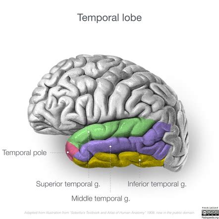 Temporal lobe | Radiology Reference Article | Radiopaedia.org