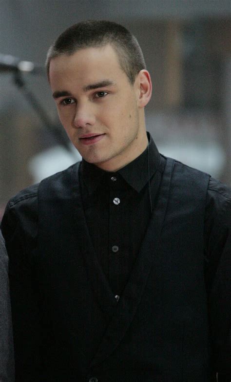 Did Liam Payne Get Plastic Surgery? Jaw, Face Photos | Life & Style