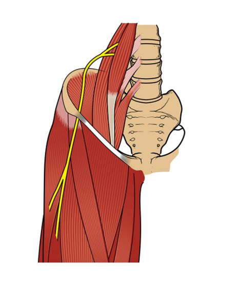 Pdf Meralgia Paresthetica A Case Report With An Update On Anatomy | Images and Photos finder