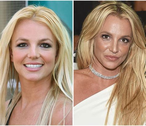 Britney Spears Before and After Plastic Surgery Reveals Her Popstar Journey