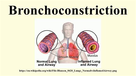 Bronchoconstriction - YouTube