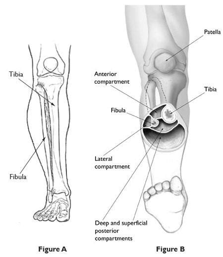 Compartment Syndrome Lower Leg Surgery Recovery Time - Captions Trendy