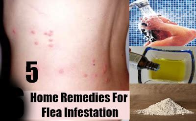 Top 5 Home Remedies for Fleas Infestation - Natural Remedies And Treatment