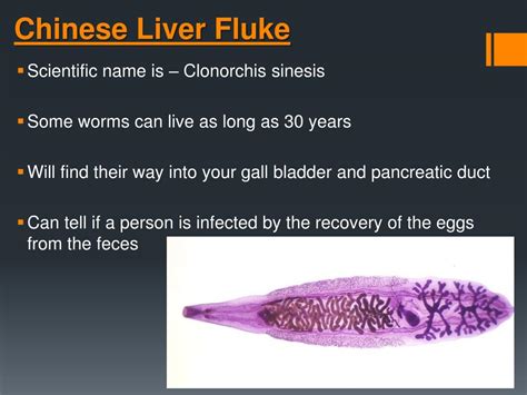 PPT - Parasites: -Giant Intestinal Fluke -Chinese Liver Fluke -Sheep ...