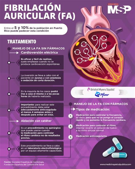 seguro Publicación Tesoro tratamiento para fibrilacion auricular ...