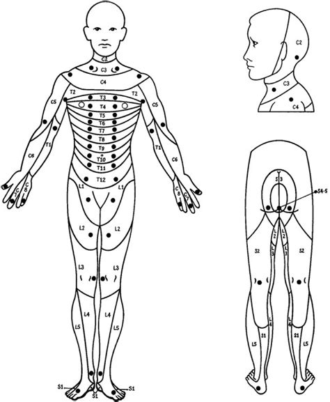 Dermatome Black And White Chart - Dermatomes Chart and Map