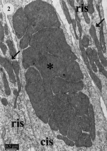 Giant mitochondria in the retina cone inner segments of shrews of genus Sorex (Insectivora ...