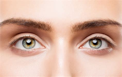 Can You Get Rid of Eye Wrinkles and Bags Without Surgery