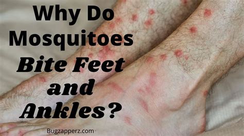 Why Do Mosquitoes Bite Ankles?