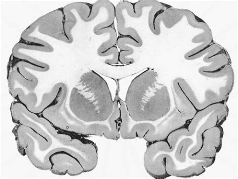 “I’m so stressed that I’m tearing my hair out” | SiOWfa16: Science in Our World: Certainty and ...