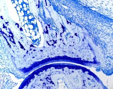 Toluidine blue special stain - mouse ankle with type II collagen ...