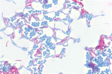 Mycobacterium smegmatis, acid-fast stained (pink, with carbolfuchsin). | Acid fast, Microbiology ...