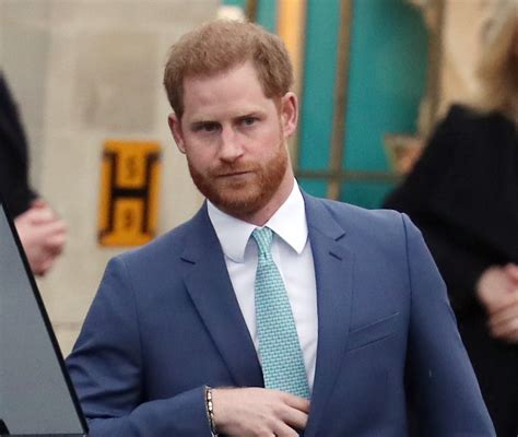 Is Prince Harry under pressure to have a hair transplant?