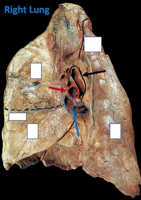 Right Lung Hilum (Cadaver) Diagram | Quizlet