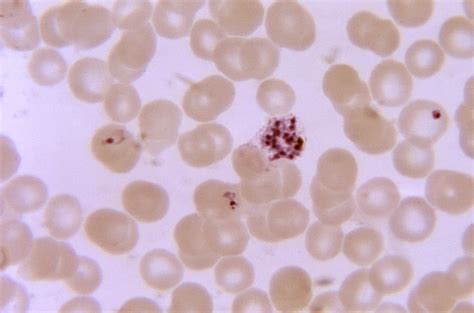 Free picture: developing, schizonts, vivax, large, amoeboid