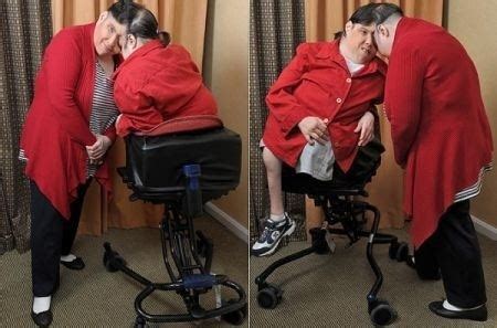 Lori and George Schappell (Conjoined Twins) ~ Bio with [ Photos | Videos ]