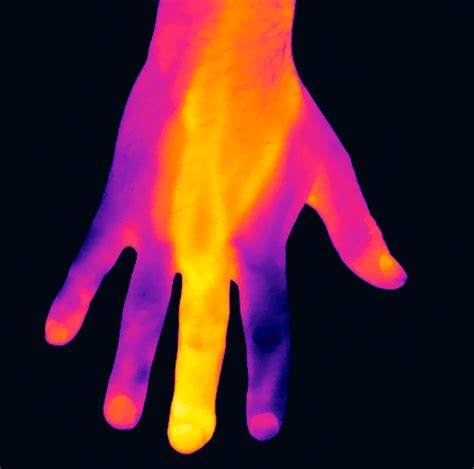 Thermogram of an inf… | Wellcome Collection