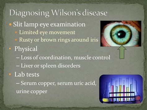 Wilsons disease