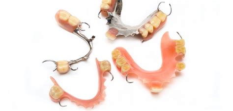 Metal or acrylic partial dentures – which one is best for you ...