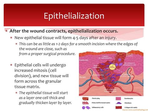 PPT - Wound Repair PowerPoint Presentation - ID:5323746