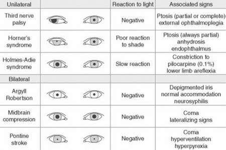 The Eye | Basicmedical Key