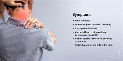 Cervical Dystonia: Symptoms and Causes Explained