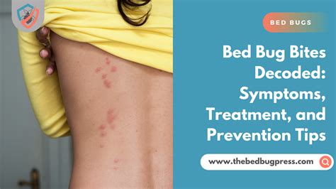 Bed Bug Bites Decoded: Symptoms, Treatments, and Prevention Tips - thebedbugpress.com