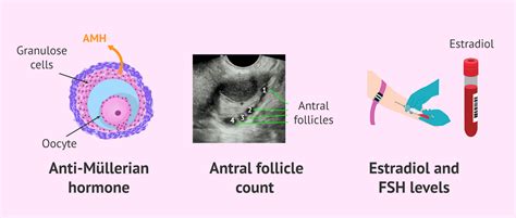 how-ovarian-reserve-evaluated