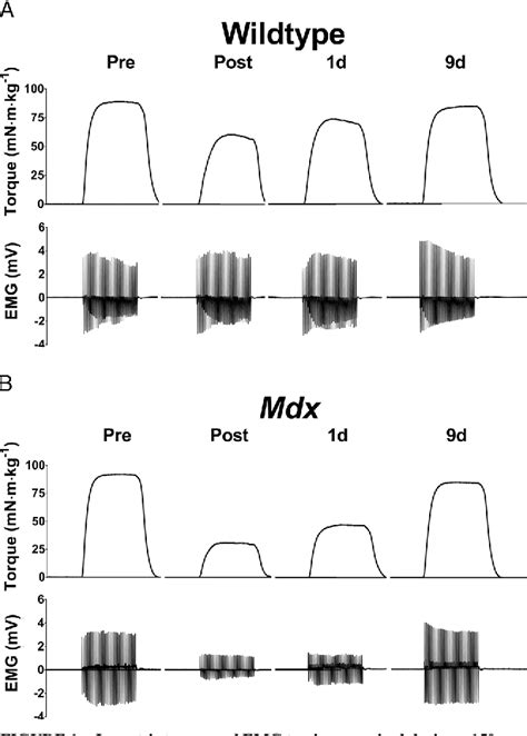 Figure 1 from Plasmalemma Function is Rapidly Restored in Mdx Muscle after Eccentric ...