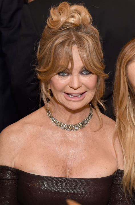 Did Goldie Hawn Get Plastic Surgery in 2017? Experts Weigh In!