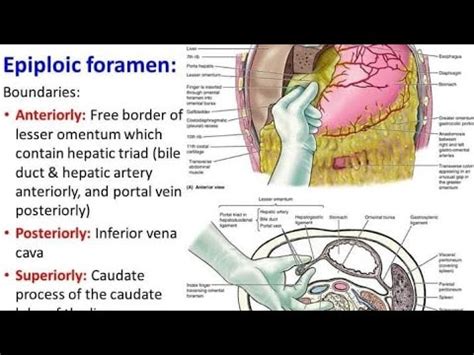 Epiploic Foramen| Omental Foramen| Foramen Of Winslow| Abdominal ...