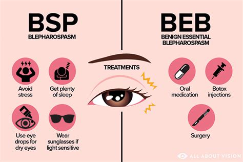 Blepharospasm: Causes, Diagnosis and Treatment | OBN