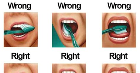 This Will Show You How to Brush Your Teeth The Right Way