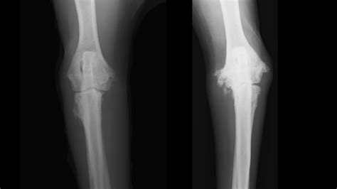 Elbow Dysplasia in Dogs | KYON