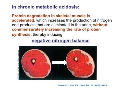 Diet-Induced Metabolic Acidosis Causes - dvdinter