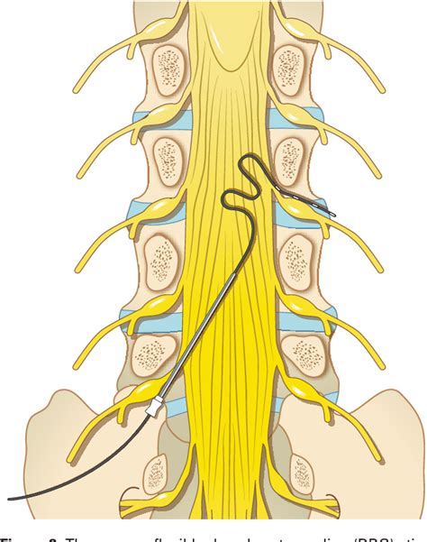 Posterior Dorsal Root Ganglion