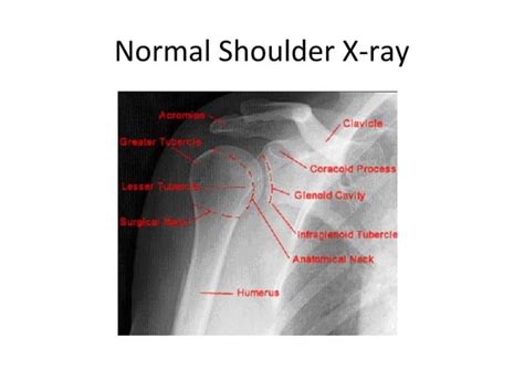 Soft tissue swelling | PPT