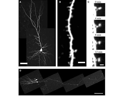 2. Two-photon imaging of living neurons in slices. Two-photon ...