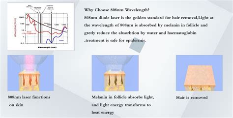 Diode Lasers - VIVA Concept Technology Co., Ltd.