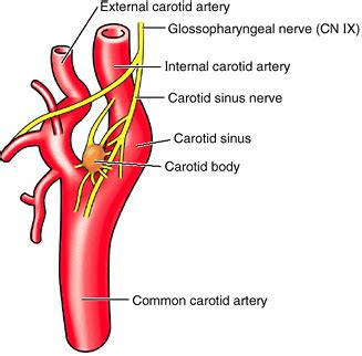 ABC Radiology Blog: Carotid Bodies