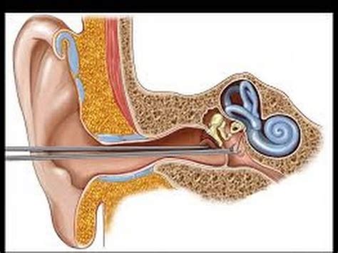 Operate Now! - Ear Surgery - YouTube