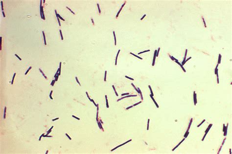 Difference Between Obligate Aerobes and Obligate Anaerobes | Compare the Difference Between ...