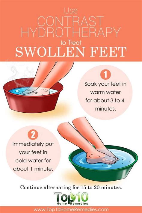 Top 10 Natural Home Remedies for Swollen Feet | Arthritis remedies ...