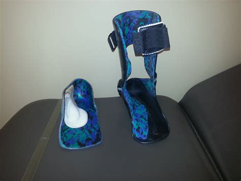 Custom molded orthotics Part 4 - Foot Doctor San Diego / La Jolla Podiatrist