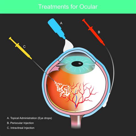 Eye conditions & treatments | Rashmi Akshikar