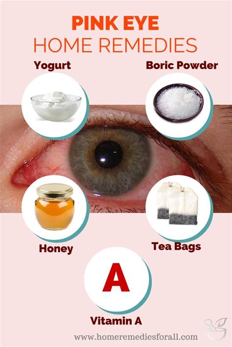 Must Know Pink Eye Home Remedies Ideas - QUIMANW