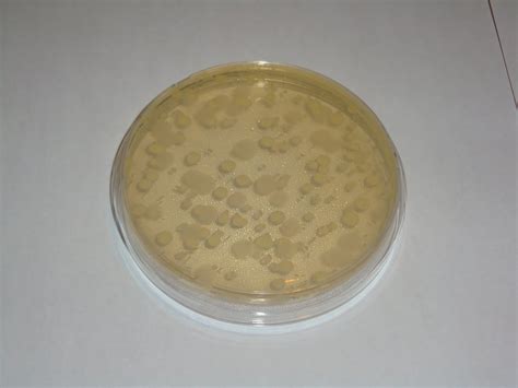 The Bacteria Growth Experiment: A Great View of the Petri Dish