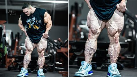 Bodybuilder Nick Walker Shows Huge Varicose Veins in Calves During Recent Update, Is It Cause ...