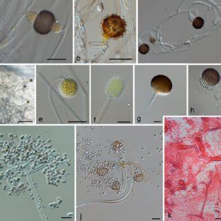 (PDF) Updates on the Taxonomy of Mucorales with an Emphasis on ...