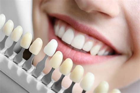 3 Reasons to Choose In-Office Teeth Whitening Services